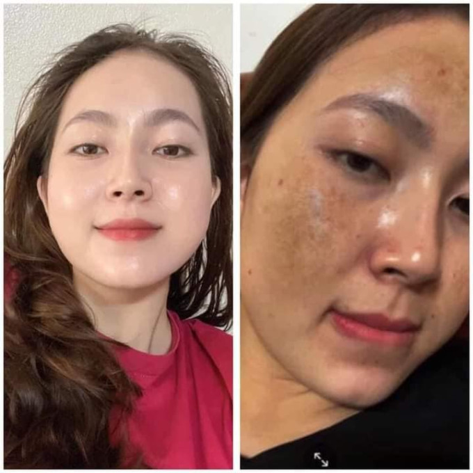Giúp dưỡng trắng da, mờ nám, mờ thâm
