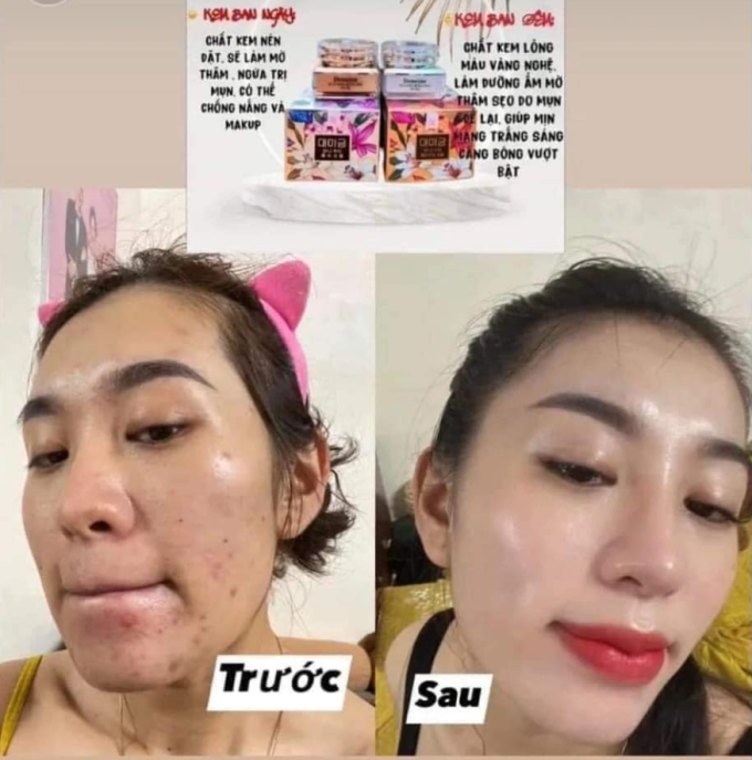 Chất kem mềm mịn thẩm thấu nhanh nhung không bết rít