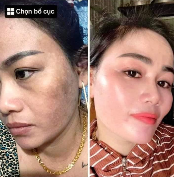 Nám da cũng mờ dần