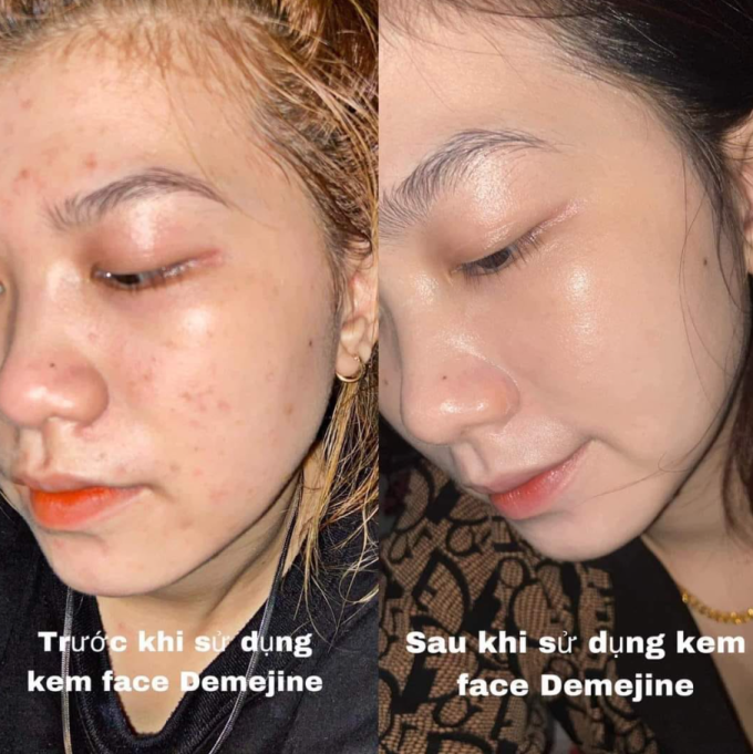 Da đẹp lên thấy rõ