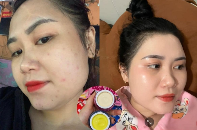 Da căng bóng mịn màng