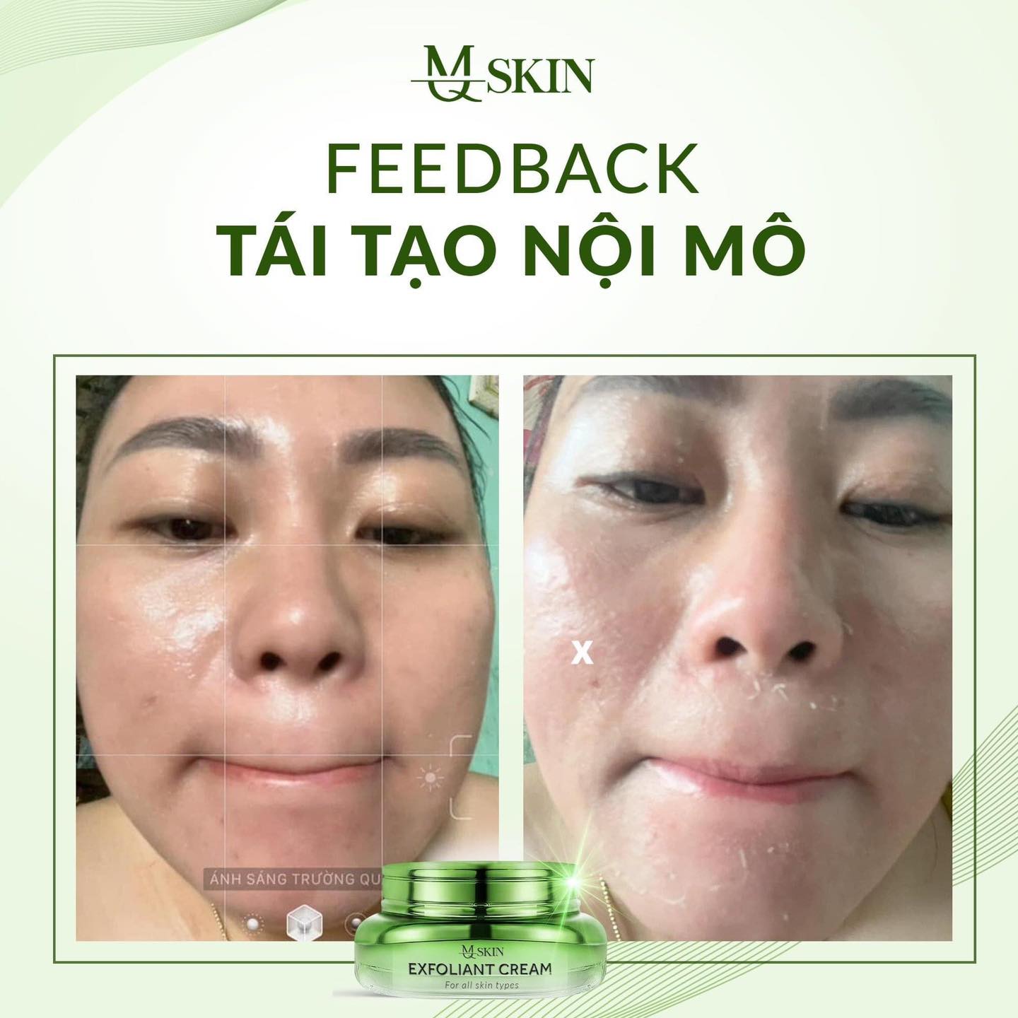 Sự khác biệt lúc chưa và lúc đã sử dụng sản phẩm