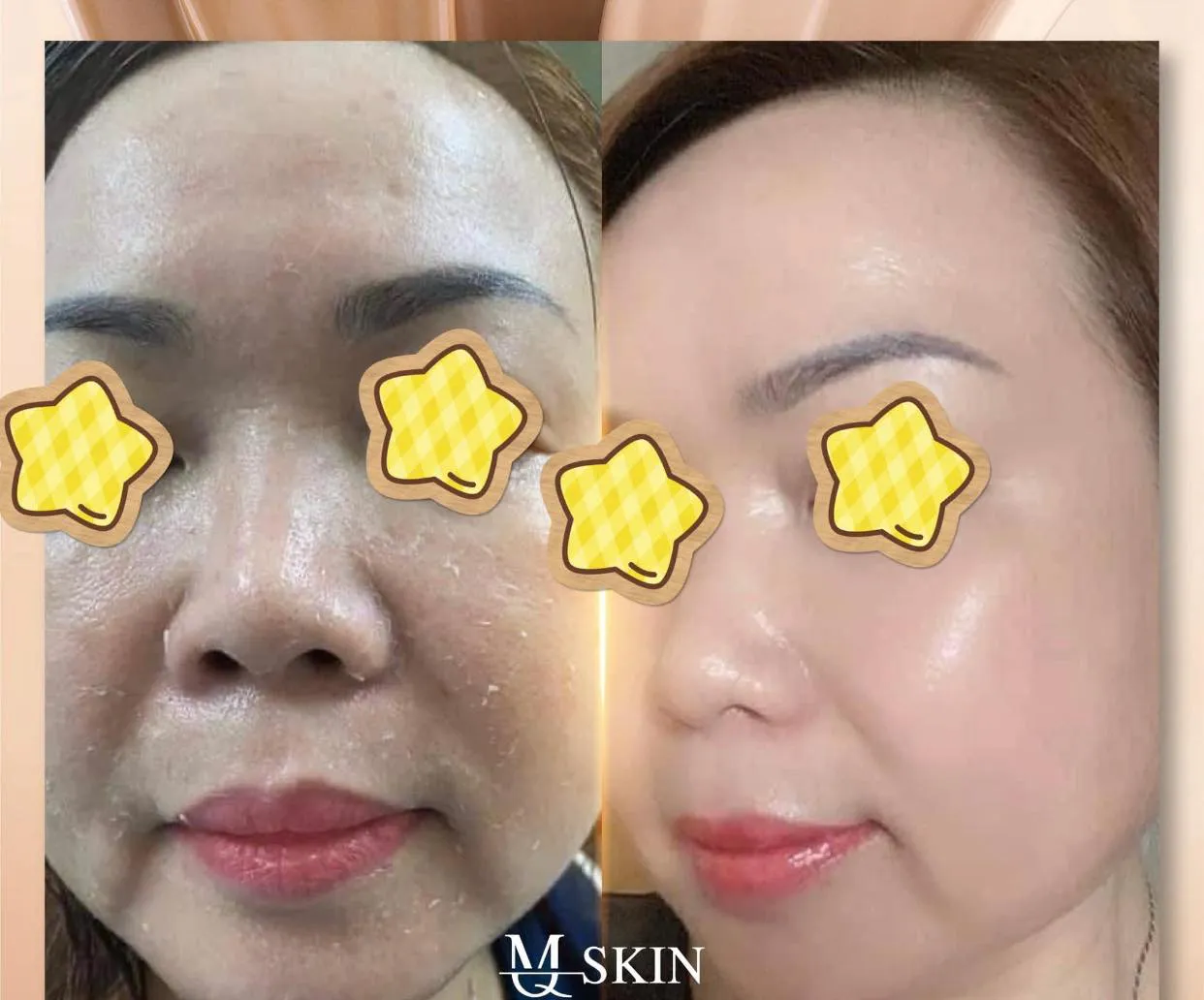 Mang lại làn da căng bóng mềm mịn