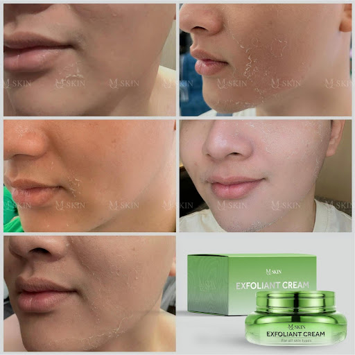Sử dụng kem tái tạo da nội sinh MQ Skin thấy được hiệu quả rõ rệt