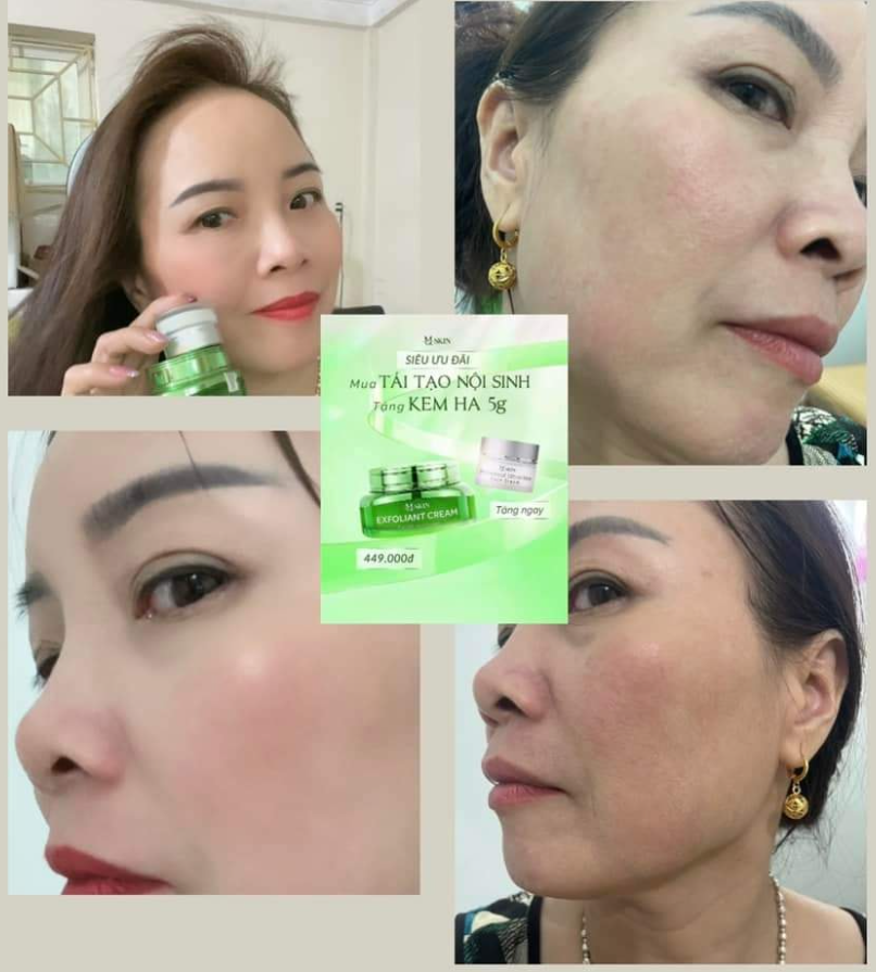 kem tái tạo da nội sinh MQ Skin giúp tái tạo da hiệu quả