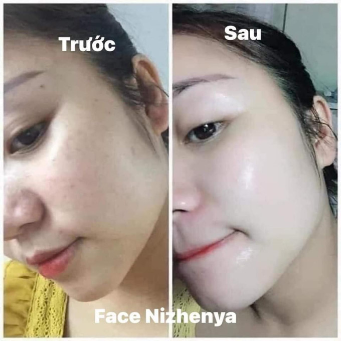 Kem Nizhenya hỗ trợ dưỡng trắng da