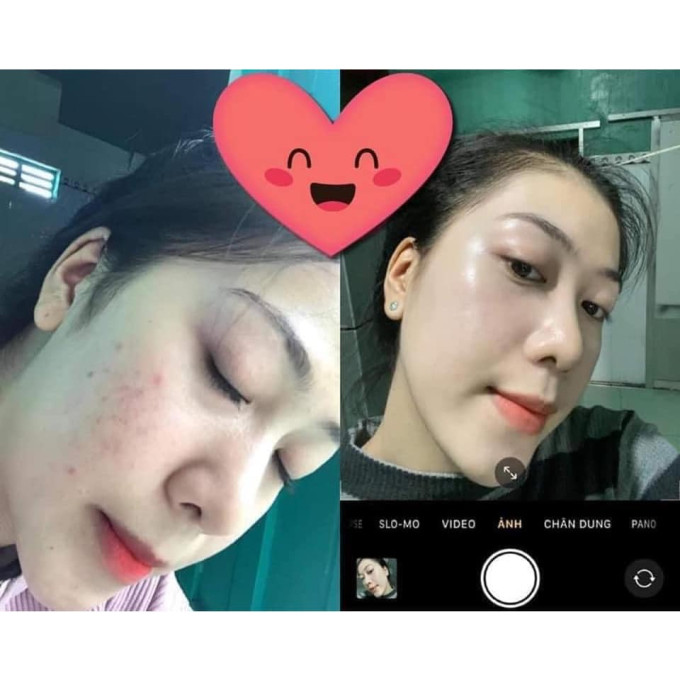 Sản phẩm không phải là kem trộn