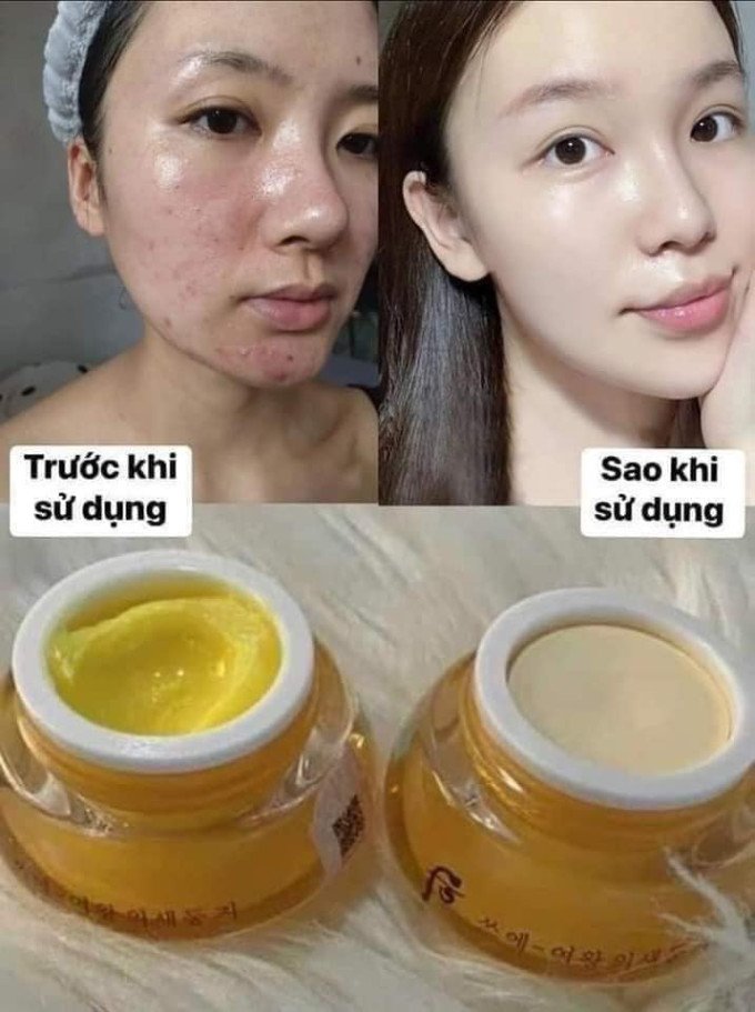 Kem Nizhenya Có Phải Kem Trộn Không? Có Tốt Không?