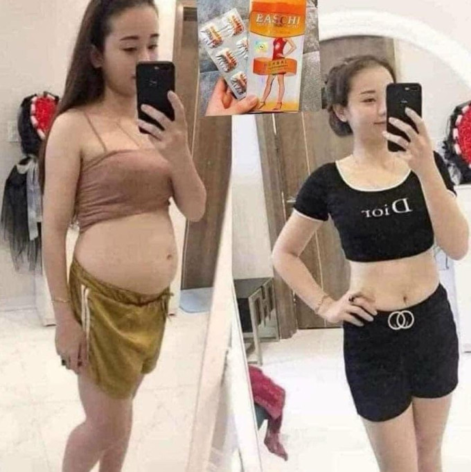Hỗ trợ giảm cân an toàn