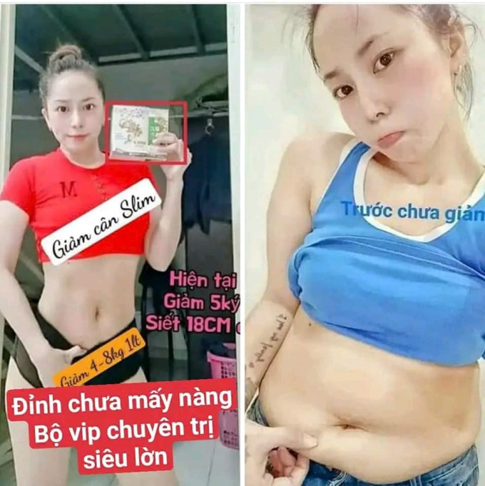 Slim X1000 giảm 4-8kg sau 1 liệu trình