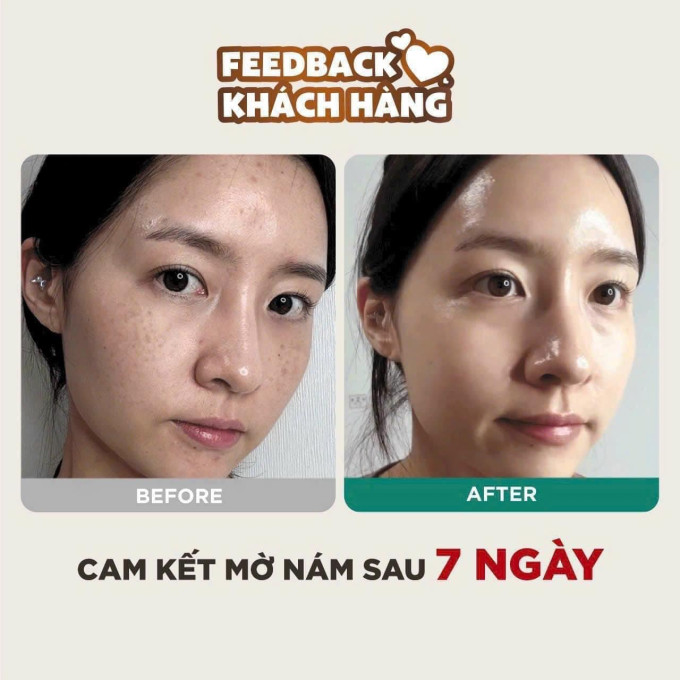 Sự thay đổi rõ rệt sau 7 ngày sử dụng