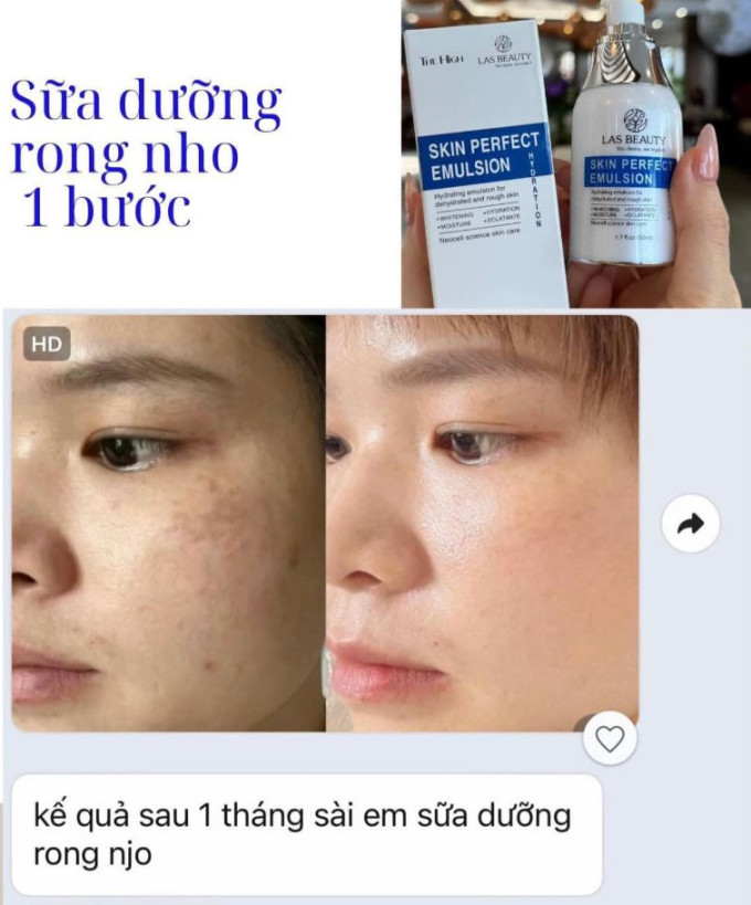 Kết quả sau 1 tháng sử dụng Sữa dưỡng rong nho