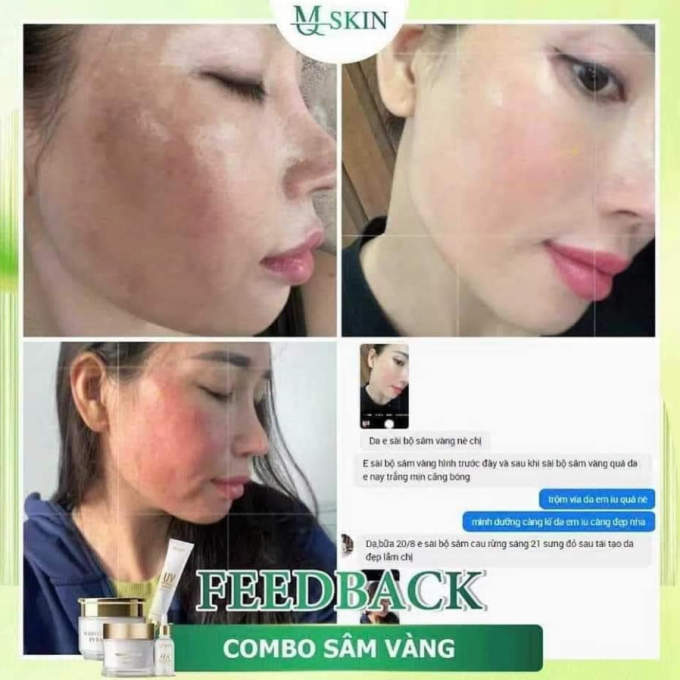 Hình ảnh feedback của khách hàng về sản phẩm tái tạo da sâm vàng mq skin