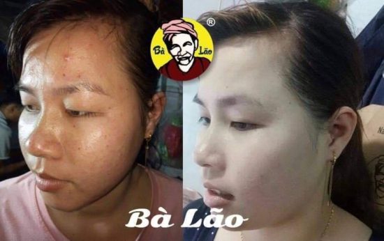 Sự khác biệt rõ rệt