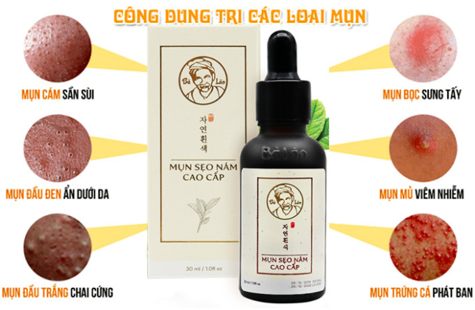 Công dụng Trị Mụn Bà Lão