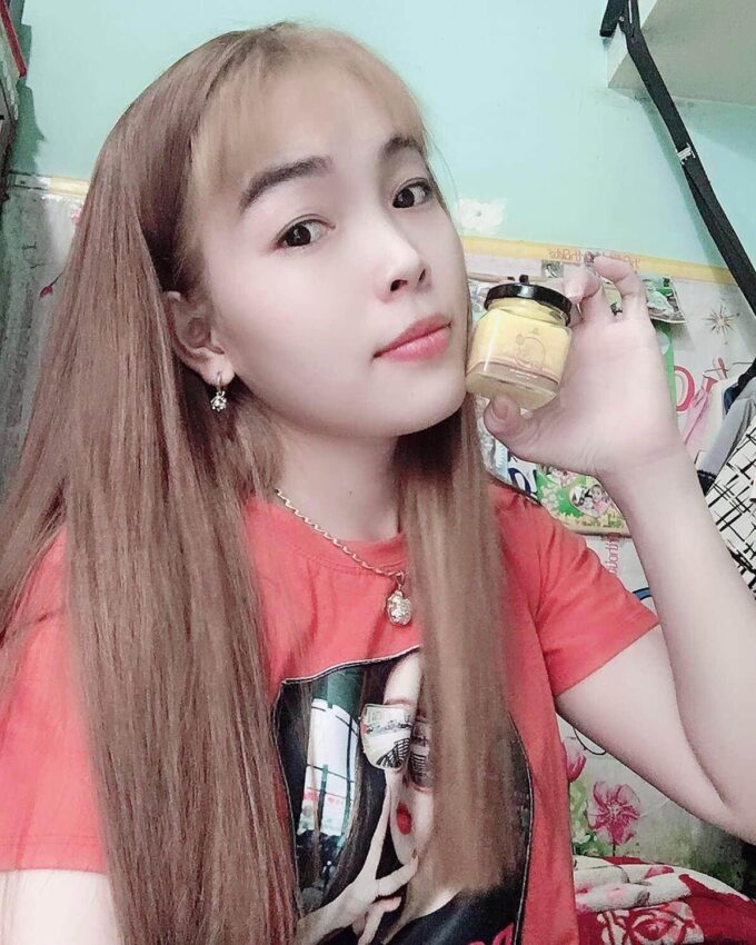 Cải thiện rõ tình trạng sa thâm sạm