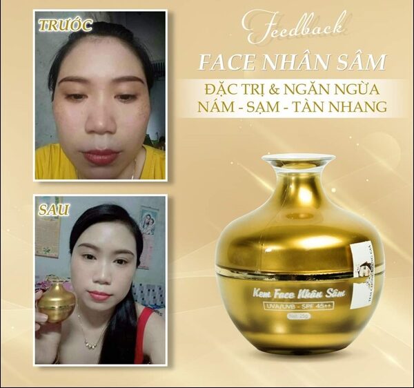 Trước và sau khi sử dụng 1 hộp