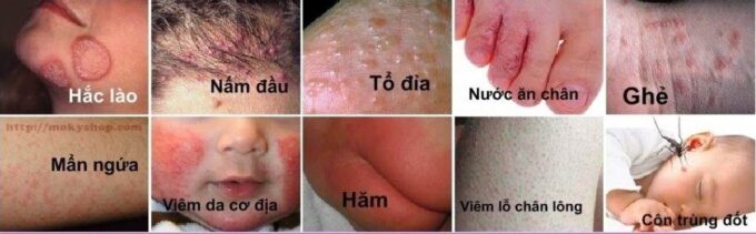 Đối tượng sử dụng kem bôi da Thuần Mộc