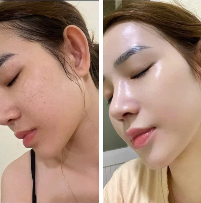 da trở nên sáng mịn và khỏe mạnh từ sâu bên trong
